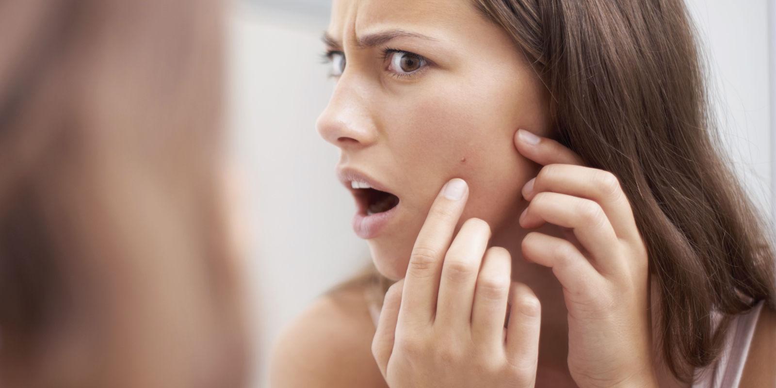 pop-a-zit